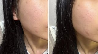 세뚜아(Cettua) 세뚜아 스팟 클리어 듀얼 패치 Cettua Spot Clear Dual Patch — 4점을 준 리뷰어가 2023년 7월 올린 사용 사진