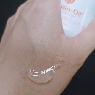 바이오오일 [바이오-오일] 드라이 스킨 젤 100ml — 5점을 준 리뷰어가 2021년 5월 올린 사용 사진