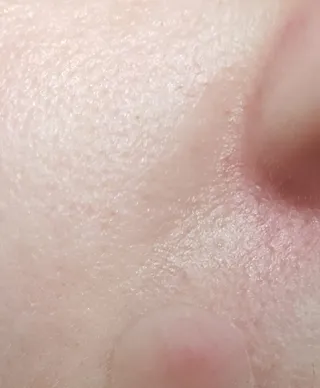 수려한 더블랙세럼 15ml — 5점을 준 리뷰어가 2022년 3월 올린 사용 사진