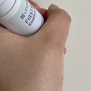 리더스코스메틱 리더스 퍼스트 샷 에센스 스틱 2종 — 4점을 준 리뷰어가 2022년 3월 올린 사용 사진