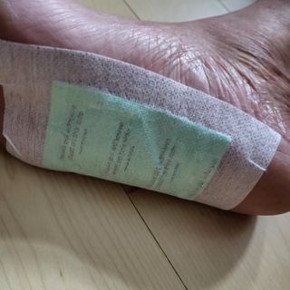 [레제르] 아로마 수액패치 발패치 30매입 -라벤더향/유칼립투스향/대나무향 — 5점을 준 리뷰어가 2022년 3월 올린 사용 사진