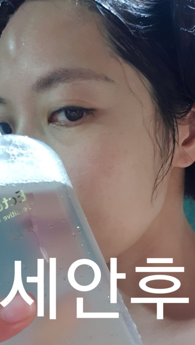 엑토마이드 G 센서티브 클렌징워터 리뷰 사진