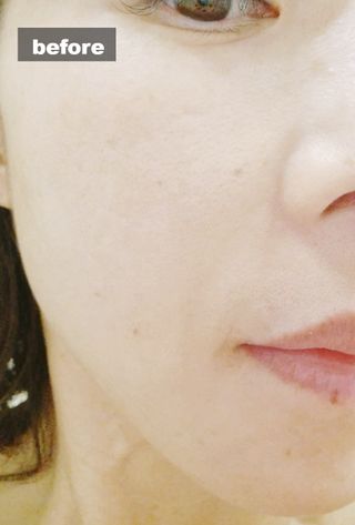 ✅프리 [밀리밀리] 메디 앰플 콜라 15ml — 5점을 준 리뷰어가 2025년 9월 올린 사용 사진