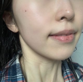 바이리뮤 에이지 홀딩 펩타톡스 앰플 — 5점을 준 리뷰어가 2021년 1월 올린 사용 사진