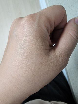 [패키지리뉴얼]보타니티 진정 결케어 플라본 부스터 210ml / 플라본 세럼 50m — 3.5점을 준 리뷰어가 2022년 5월 올린 사용 사진