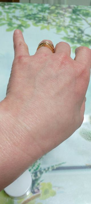 바이오오일 [바이오-오일] 스킨케어 오일 내추럴 60ml — 5점을 준 리뷰어가 2021년 12월 올린 사용 사진