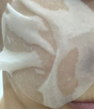 랑벨 랑바이오 블랙 시카 퀵 패드 100매 (3초 쿨링/3분 흡수, 블랙비 프로폴리스/시카 4종 함유, 대용량) — 5점을 준 리뷰어가 2022년 7월 올린 사용 사진
