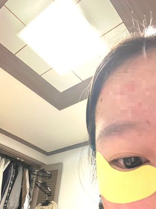 세뚜아(Cettua) [세뚜아] 비타풀 아이 패치 Cettua Vita-Full Eye Patch — 5점을 준 리뷰어가 2023년 9월 올린 사용 사진