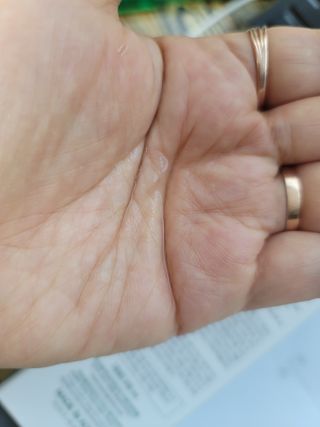 팜스테이 티트리 바이옴 카밍 토너 — 5점을 준 리뷰어가 2022년 3월 올린 사용 사진