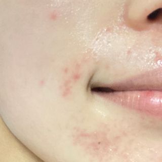 리더스코스메틱 리더스 카밍 바이오틱스 크림 마스크 — 5점을 준 리뷰어가 2021년 4월 올린 사용 사진