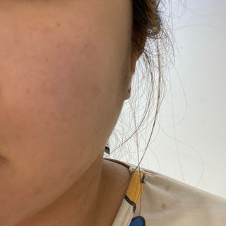 체르엠 스템앤셀 비타민 브라이트닝 에센스 30ml 1개 — 4점을 준 리뷰어가 2021년 9월 올린 사용 사진