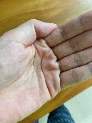 리더스코스메틱 리더스 헤어 라피 헤어 로스 컨트롤 토닉 — 5점을 준 리뷰어가 2021년 1월 올린 사용 사진