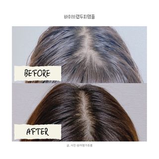 바이브랩 [탈모증상완화] 헤어라인 눈썹 두피앰플 — 5점을 준 리뷰어가 2022년 3월 올린 사용 사진