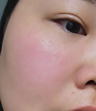 MF[스킨1004] 마다가스카르 센텔라 앰플 100ml — 5점을 준 리뷰어가 2024년 5월 올린 사용 사진