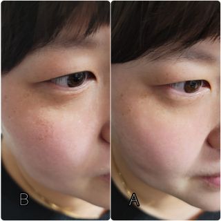 이엔코스 알부틴 알파 화이트닝크림 — 5점을 준 리뷰어가 2021년 3월 올린 사용 사진
