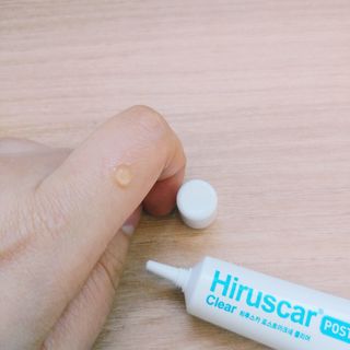 히루스카 포스트아크네 클리어 — 4점을 준 리뷰어가 2021년 2월 올린 사용 사진