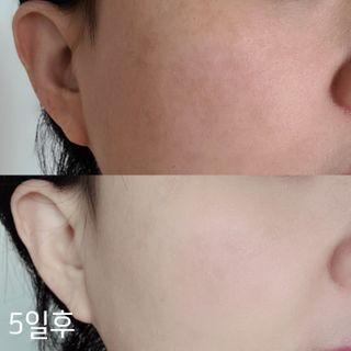 이엔코스 알부틴 알파 화이트닝크림 — 5점을 준 리뷰어가 2021년 2월 올린 사용 사진