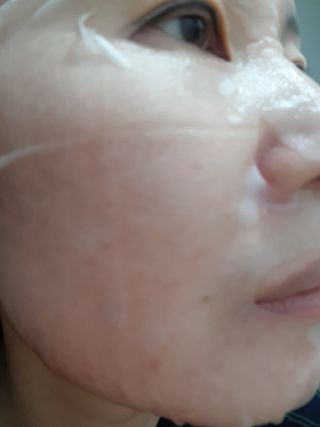 아미퓨어 촉촉하고 밝은 피부를 만들어주는 1일1팩, 아미노이펙트 마스크 10매 — 5점을 준 리뷰어가 2021년 6월 올린 사용 사진
