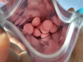 푸름웰니스 라바 쑥쑥구미 36g — 5점을 준 리뷰어가 2022년 5월 올린 사용 사진