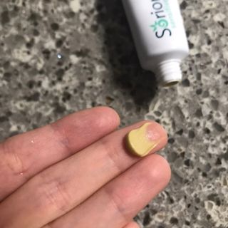 건선/아토/습진/민감성 피부 천연보습진정크림 소리온 크림 & 센시티브 크림 50g — 2.5점을 준 리뷰어가 2022년 3월 올린 사용 사진