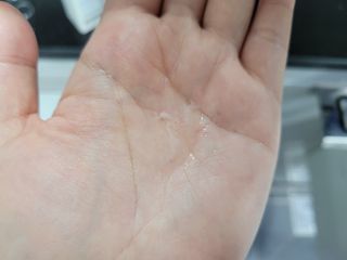 클라우드랩 프리미엄 비오틴 스칼프 케어 토닉 — 4점을 준 리뷰어가 2021년 5월 올린 사용 사진