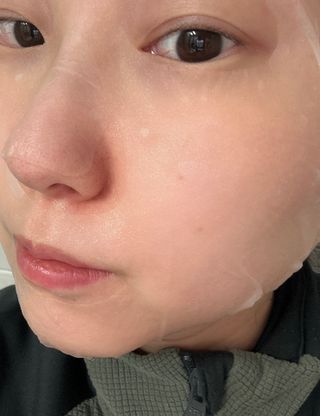 비프리코스메틱 더블아이스진정마스크팩 5매 — 5점을 준 리뷰어가 2023년 2월 올린 사용 사진