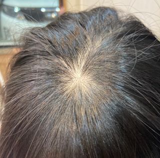 비어멕 독일맥주효모 천연탈모샴푸 — 5점을 준 리뷰어가 2021년 2월 올린 사용 사진