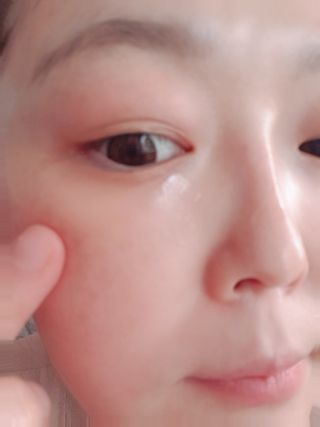 아이앤립 / EYENLIP 아이앤립 연어오일 리바이탈라이징 앰플 — 5점을 준 리뷰어가 2021년 3월 올린 사용 사진