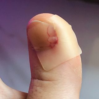 [큐어반H 커팅] 간편하게 떼서 쓰는 자외선차단 습윤밴드 (1팩/30매입) — 4.5점을 준 리뷰어가 2022년 11월 올린 사용 사진
