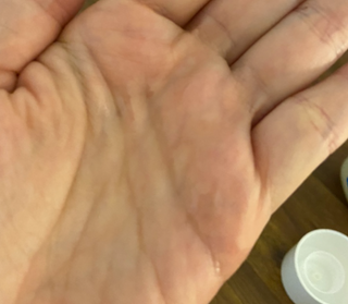 바이오오일 [바이오-오일] 스킨케어 오일 내추럴 60ml — 5점을 준 리뷰어가 2021년 5월 올린 사용 사진