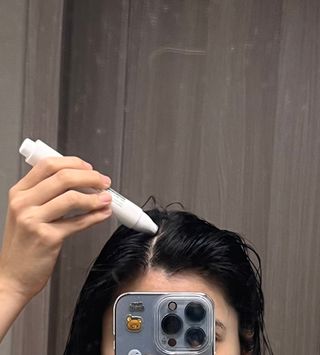 바이브랩 [탈모증상완화] 헤어라인 눈썹 두피앰플 — 5점을 준 리뷰어가 2022년 1월 올린 사용 사진