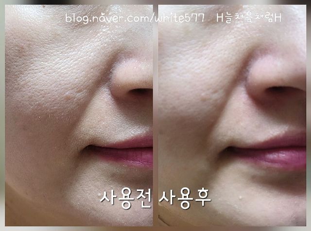 나우 [리브엠] 화해 1등 각질 클렌저! 시카좀 카밍 딥 클렌징 폼 리뷰 사진
