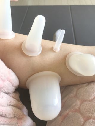 메디미케이알 커핑테라피 실리콘부항마사지 리프팅 페이스+바디 안티 셀룰 라이트 6pcs — 5점을 준 리뷰어가 2021년 2월 올린 사용 사진