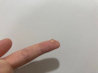 히루스카 포스트아크네 클리어 — 4점을 준 리뷰어가 2021년 2월 올린 사용 사진