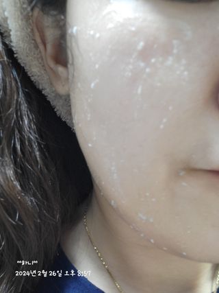[후르디아] 아보카도 비건 약산성 효소필링젤 — 5점을 준 리뷰어가 2024년 2월 올린 사용 사진