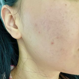 A.C PROMISE LINE 임상시험회사에서 제대로 만든, 민감성피부를 위한 트러블 기초라인 — 5점을 준 리뷰어가 2023년 7월 올린 사용 사진