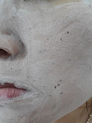 프롬노시베 로지 클레이 버블 팩 — 5점을 준 리뷰어가 2022년 1월 올린 사용 사진