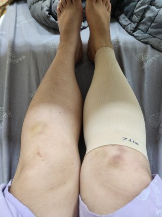 하트플로우 종아리 압박 밴드 스타킹 — 5점을 준 리뷰어가 2022년 10월 올린 사용 사진