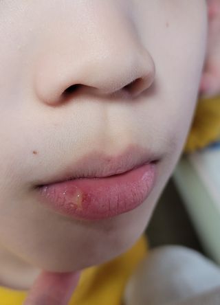 [후르디아] 올리브영 착한보습 비건 립버터 2종 — 4점을 준 리뷰어가 2022년 11월 올린 사용 사진