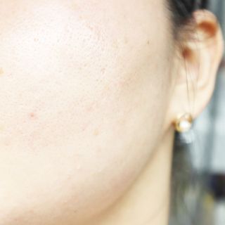 [후르디아] 골라쓰는 비건마스크팩 2종 -백년초 / 망고 — 4점을 준 리뷰어가 2022년 1월 올린 사용 사진