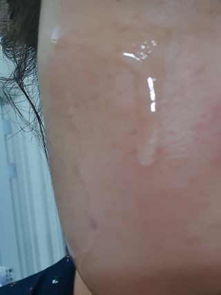 렉스리 닥터 올인원 세럼 Rexri Dr.All-in-one Serum — 5점을 준 리뷰어가 2022년 11월 올린 사용 사진