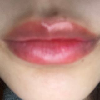 아이디플라코스메틱 페이스핏 투명 립 핏러 — 4점을 준 리뷰어가 2021년 6월 올린 사용 사진
