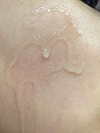 나우 [리브엠] 화해 1등 진정 앰플, 엑소코어 카밍 텐션 앰플 — 5점을 준 리뷰어가 2023년 5월 올린 사용 사진
