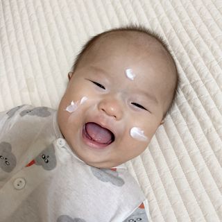 젠바이오 코스메틱스 젠바이오수딩크림]   가려운 피부 & 아토피 원픽 크림 — 5점을 준 리뷰어가 2022년 9월 올린 사용 사진