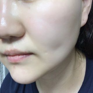 냉장고에 넣어요, 붉은 트러블 피부 다음날 진정되요 [버진팜스 푸딩수딩아토] — 5점을 준 리뷰어가 2021년 1월 올린 사용 사진