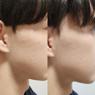 그리니프 포맨 내추럴 비비크림 50g — 4점을 준 리뷰어가 2023년 4월 올린 사용 사진