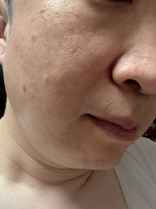 [쿠팡●구매평] 닥터초이스 디판테놀 시카 만능 버블토너 150ml — 5점을 준 리뷰어가 2025년 7월 올린 사용 사진