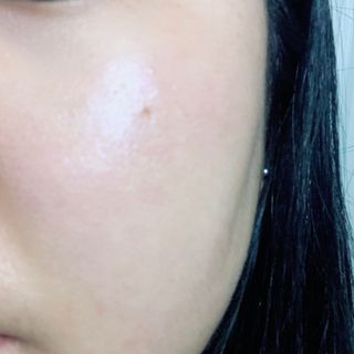 건선/아토/습진/민감성 피부 천연보습진정크림 소리온 크림 & 센시티브 크림 50g — 5점을 준 리뷰어가 2022년 1월 올린 사용 사진