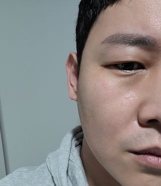 아이디플라코스메틱 아이디 페이스핏 마이너스 앰플 — 4.5점을 준 리뷰어가 2022년 3월 올린 사용 사진