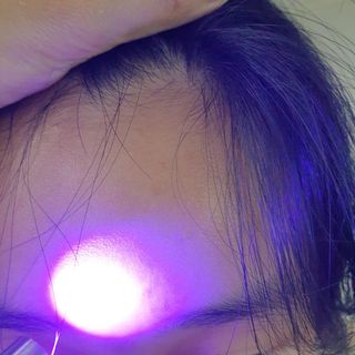메데스 비츠케어 모공케어 피부관리키트 — 5점을 준 리뷰어가 2021년 8월 올린 사용 사진
